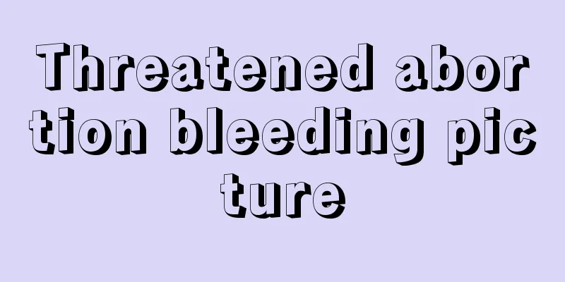 Threatened abortion bleeding picture