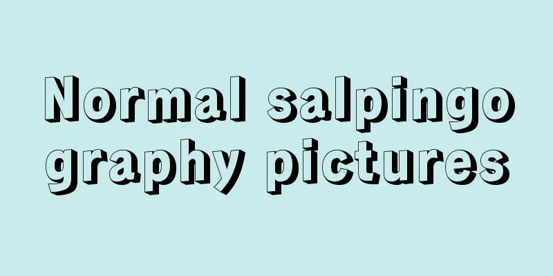 Normal salpingography pictures