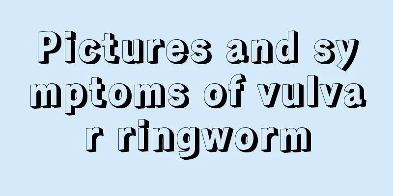 Pictures and symptoms of vulvar ringworm