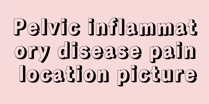 Pelvic inflammatory disease pain location picture