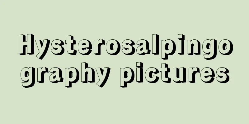 Hysterosalpingography pictures