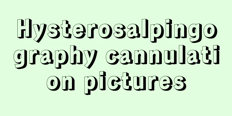 Hysterosalpingography cannulation pictures