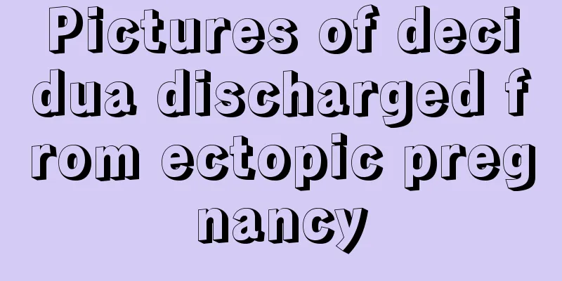 Pictures of decidua discharged from ectopic pregnancy