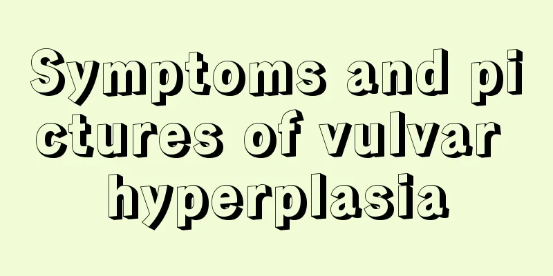 Symptoms and pictures of vulvar hyperplasia