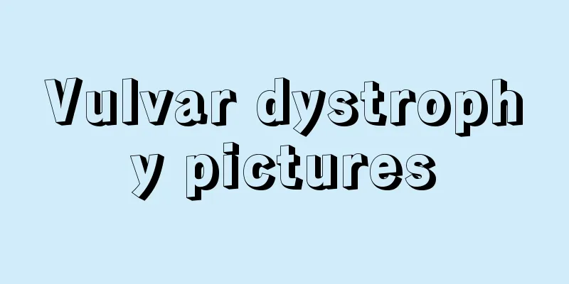 Vulvar dystrophy pictures