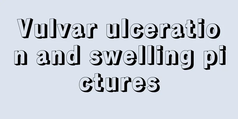 Vulvar ulceration and swelling pictures