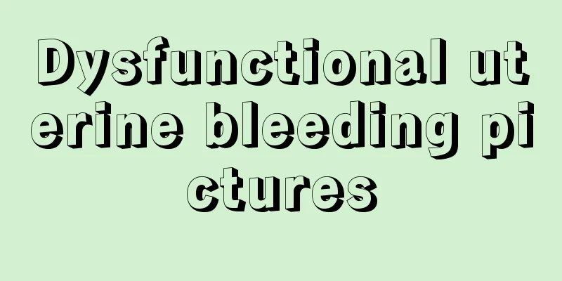 Dysfunctional uterine bleeding pictures