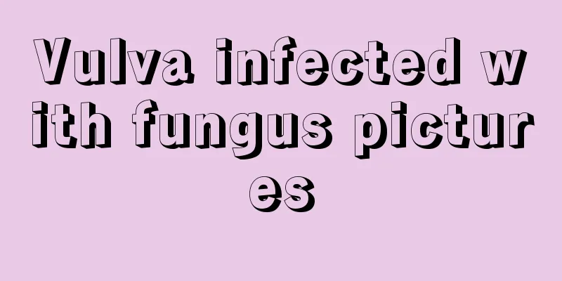 Vulva infected with fungus pictures