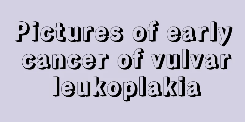 Pictures of early cancer of vulvar leukoplakia