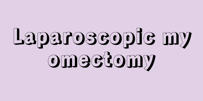 Laparoscopic myomectomy