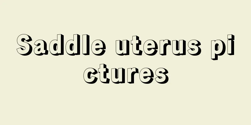 Saddle uterus pictures