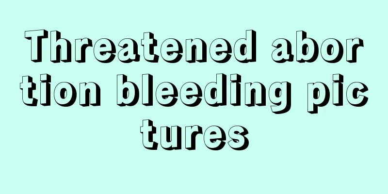 Threatened abortion bleeding pictures