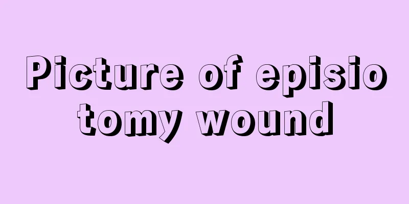 Picture of episiotomy wound