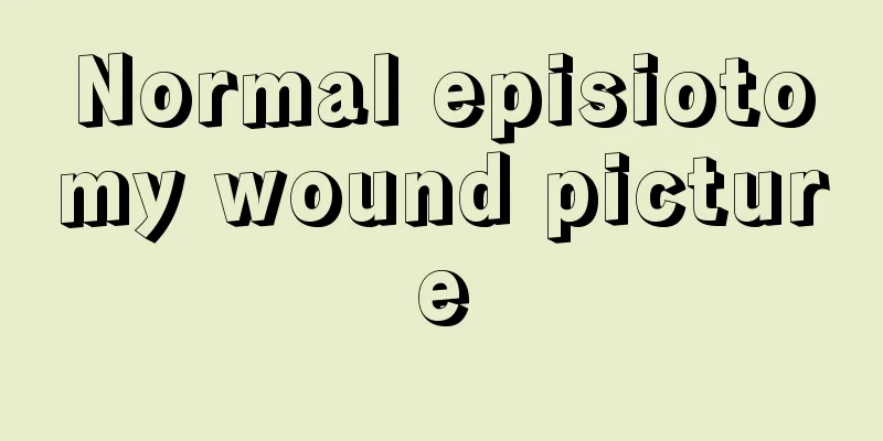 Normal episiotomy wound picture