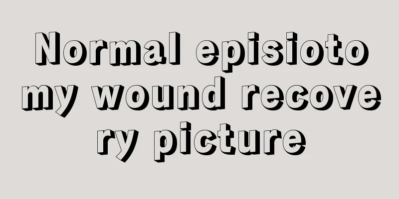 Normal episiotomy wound recovery picture