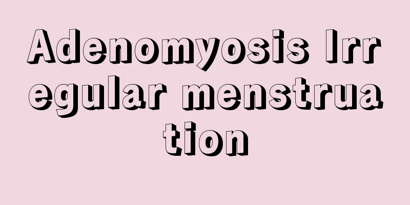 Adenomyosis Irregular menstruation