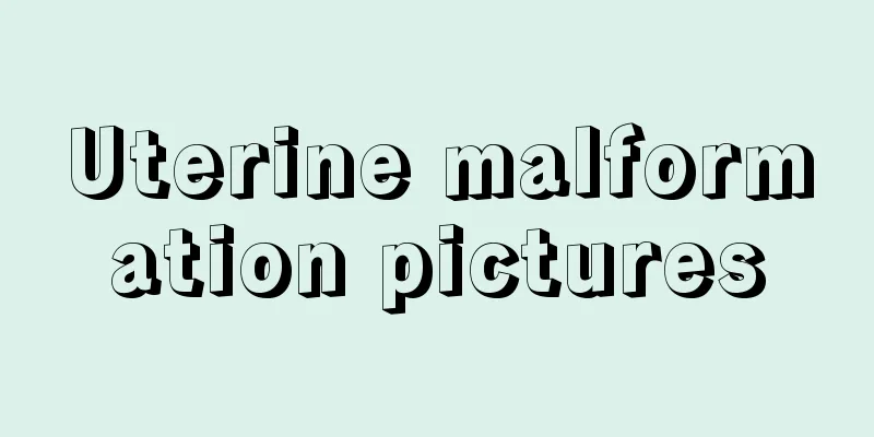 Uterine malformation pictures