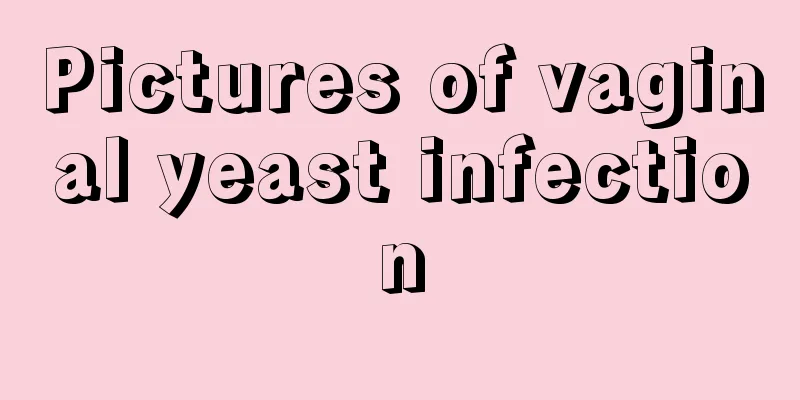 Pictures of vaginal yeast infection