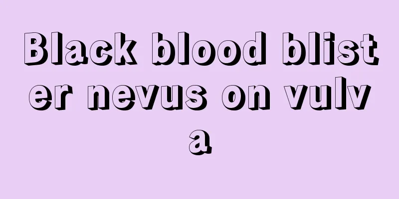 Black blood blister nevus on vulva