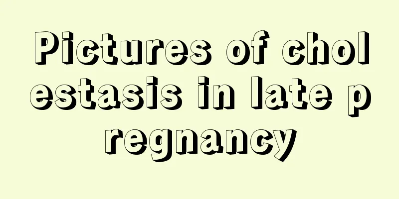 Pictures of cholestasis in late pregnancy