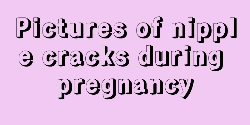 Pictures of nipple cracks during pregnancy