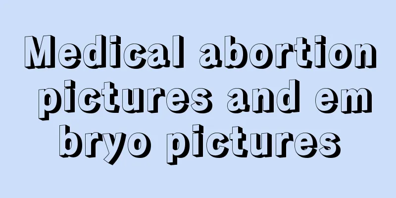 Medical abortion pictures and embryo pictures