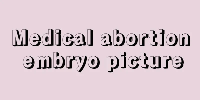 Medical abortion embryo picture