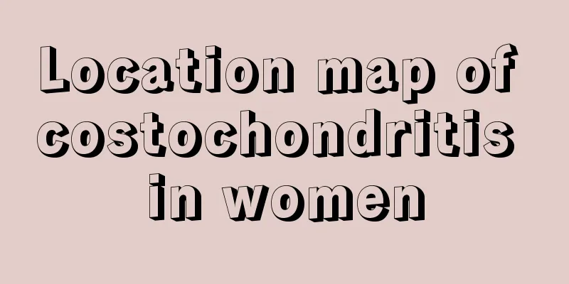 Location map of costochondritis in women