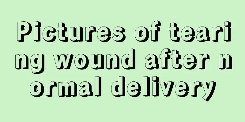 Pictures of tearing wound after normal delivery