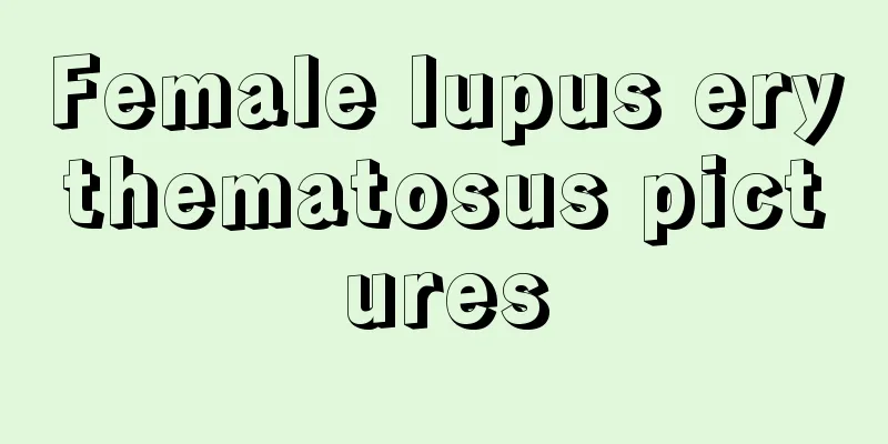 Female lupus erythematosus pictures