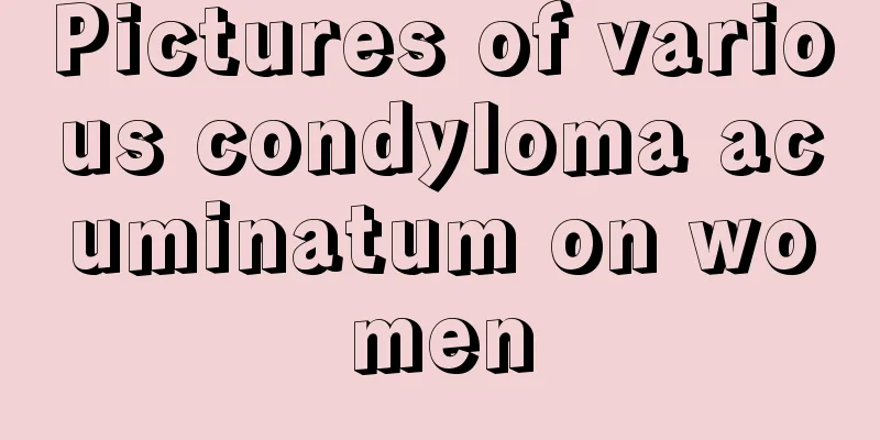 Pictures of various condyloma acuminatum on women