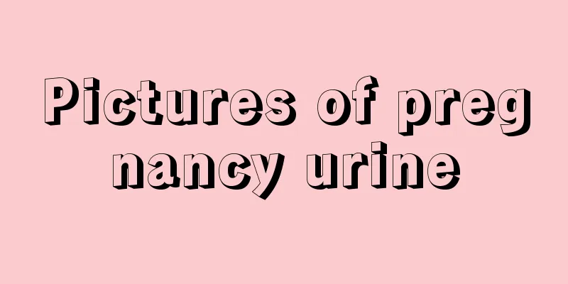 Pictures of pregnancy urine