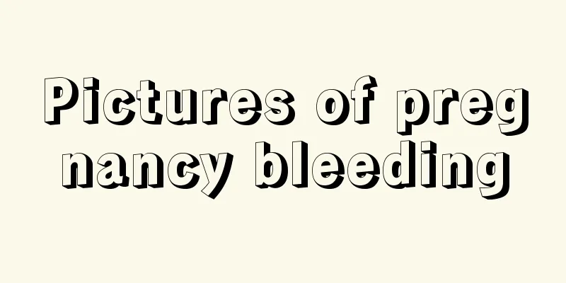 Pictures of pregnancy bleeding