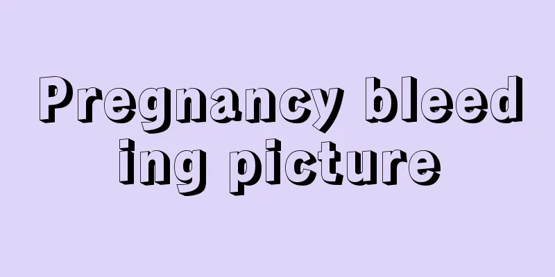 Pregnancy bleeding picture