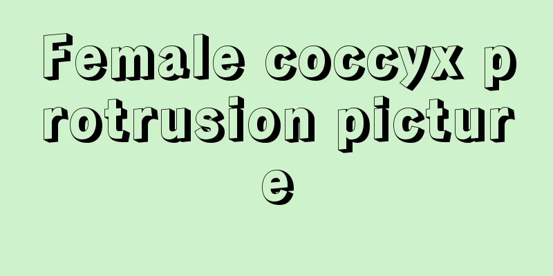 Female coccyx protrusion picture