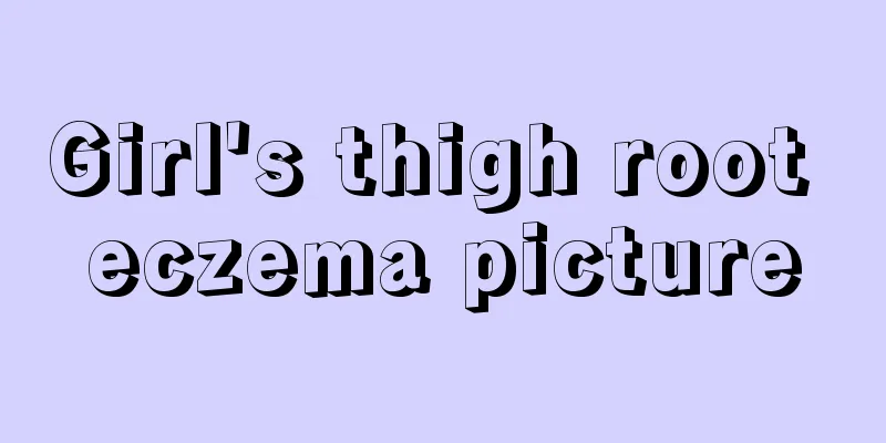 Girl's thigh root eczema picture