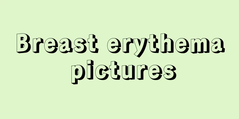 Breast erythema pictures