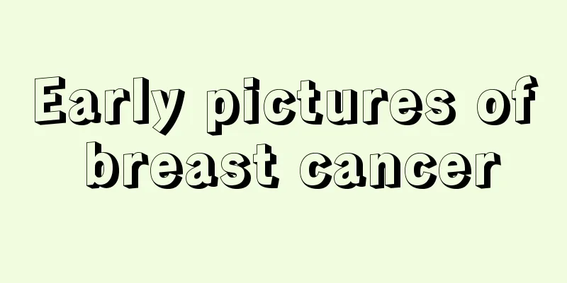 Early pictures of breast cancer