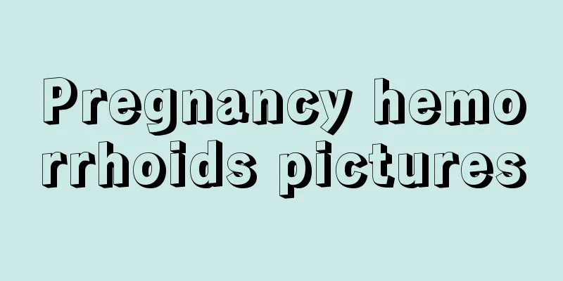 Pregnancy hemorrhoids pictures