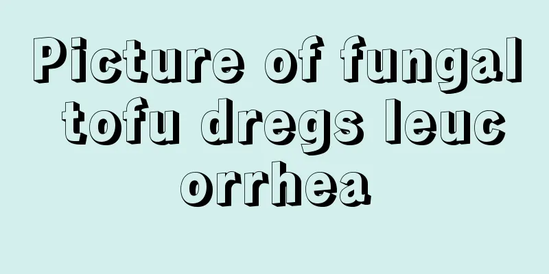 Picture of fungal tofu dregs leucorrhea