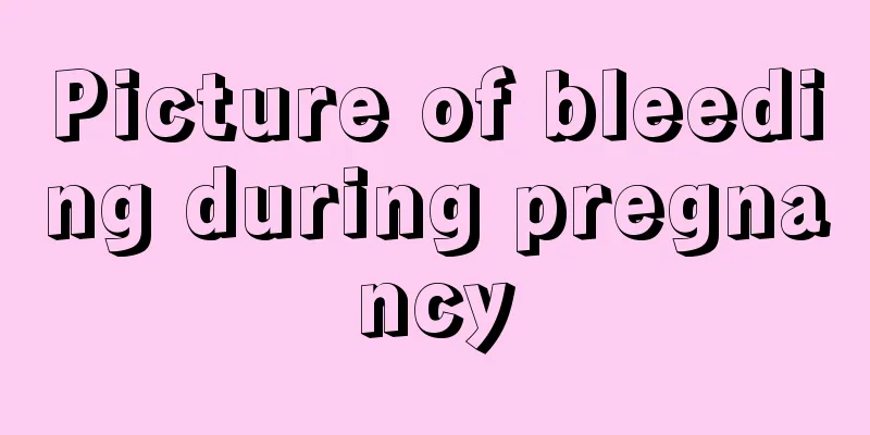 Picture of bleeding during pregnancy