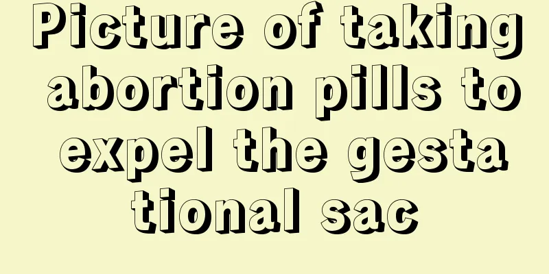 Picture of taking abortion pills to expel the gestational sac