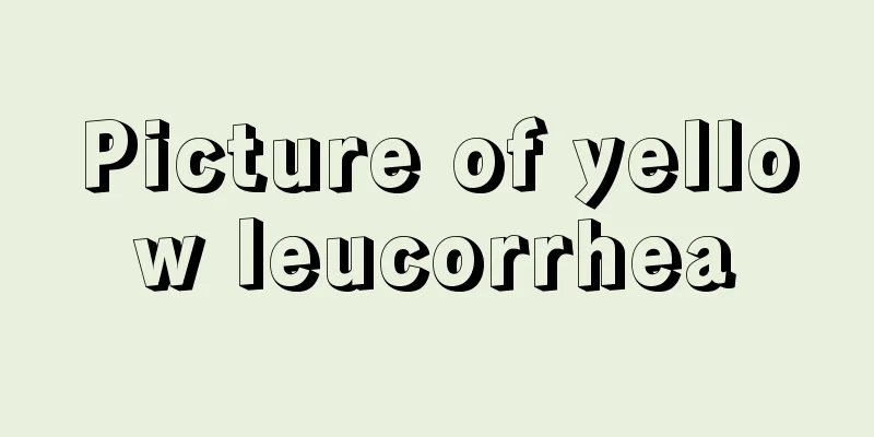 Picture of yellow leucorrhea