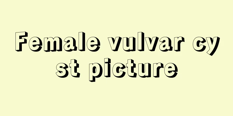 Female vulvar cyst picture