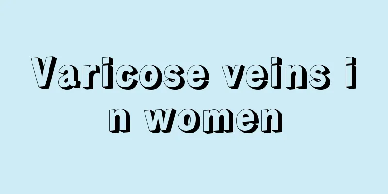 Varicose veins in women