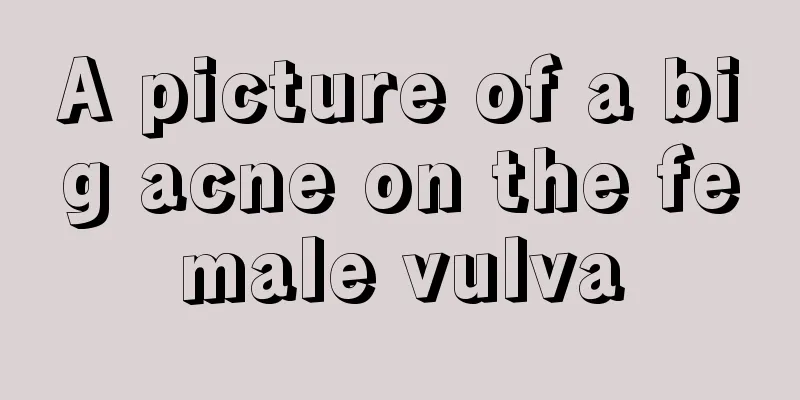 A picture of a big acne on the female vulva