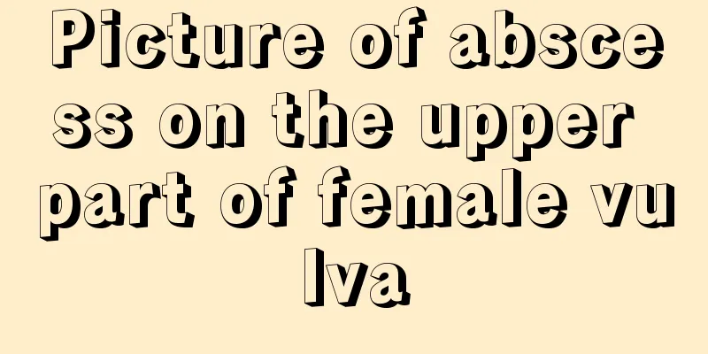 Picture of abscess on the upper part of female vulva