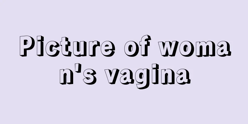 Picture of woman's vagina