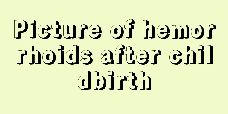 Picture of hemorrhoids after childbirth