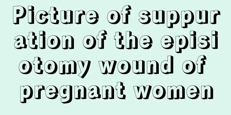 Picture of suppuration of the episiotomy wound of pregnant women